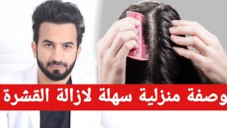 وصفة لازالة القشرة من الشعر طريقة منزلية سهلة وسريعة - دكتور طلال المحيسن