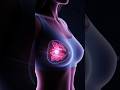 Breast Cancer Starts SILENTLY… Here’s What Science Now Knows!