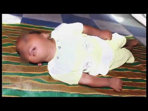 C Midi Je Tiens A Mon Enfant Malforme Malgre La Demission De Son Pere Theme Du Jour Partie 2 Youtube