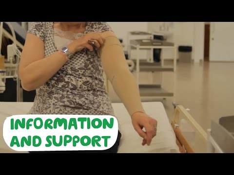 Lymphoedema and compression garments - Macmillan Cancer Support