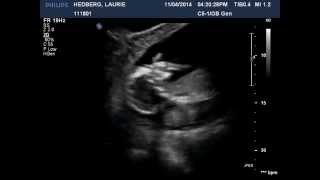 Download lagu Baby Hedberg November 2014 Baby Hedberg November 2014
