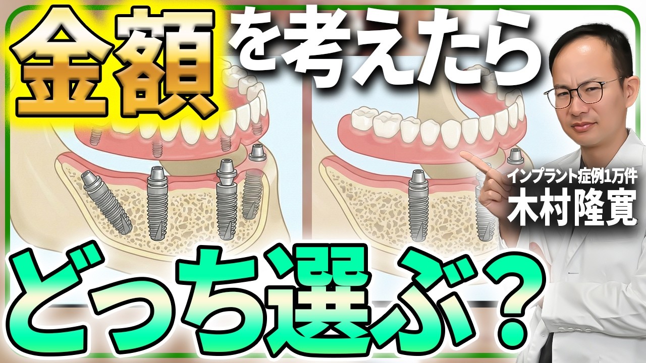 無歯顎多数歯欠損症例におけるインプラント治療 - YouTube