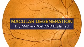 Macular Degeneration Explained - Diagnosis, Symptoms and Treatment of Dry and Wet AMD