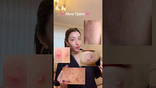 enn önemli başlangıç, ciltteki sorunu bilmek ve cilt tipini tanımak. #skincare #ciltbakımı #keşfet