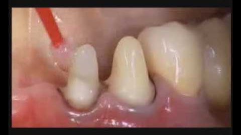 Multilink Automix.flv