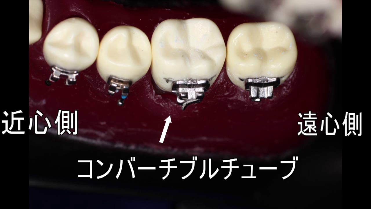 歯科矯正学実習 : Web動画付 歯科矯正学実習: Web動画付 | 新井 一仁, 飯島 重樹, 玉置 幸雄