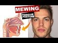 MEWING Tongue Posture | Train Your Tongue to Attach to Your Mouth