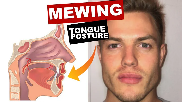 Améliorez votre apparence grâce à la posture linguale Mewing