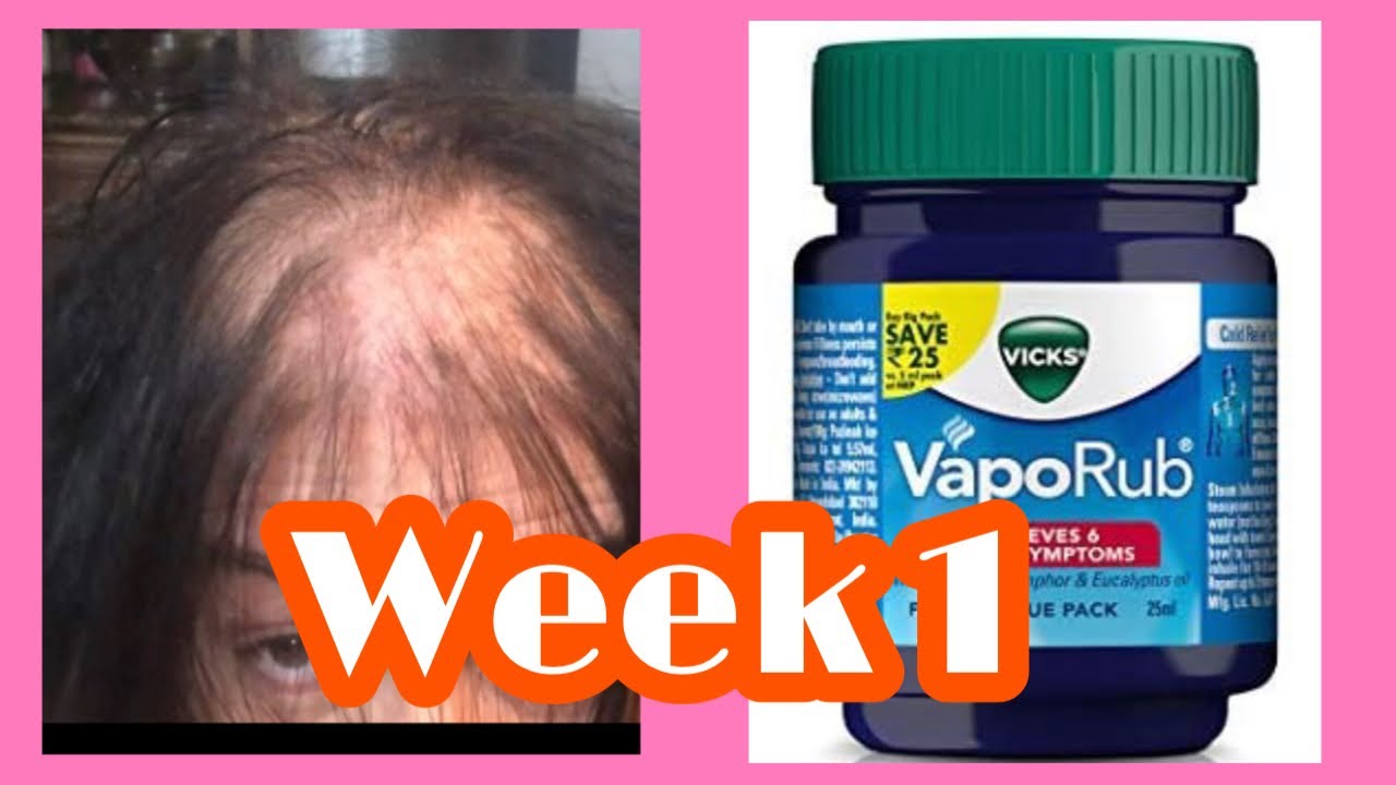 Week 1 Vick Vapor Rub Hair Growth Challenge. Is there a difference? -  YouTube