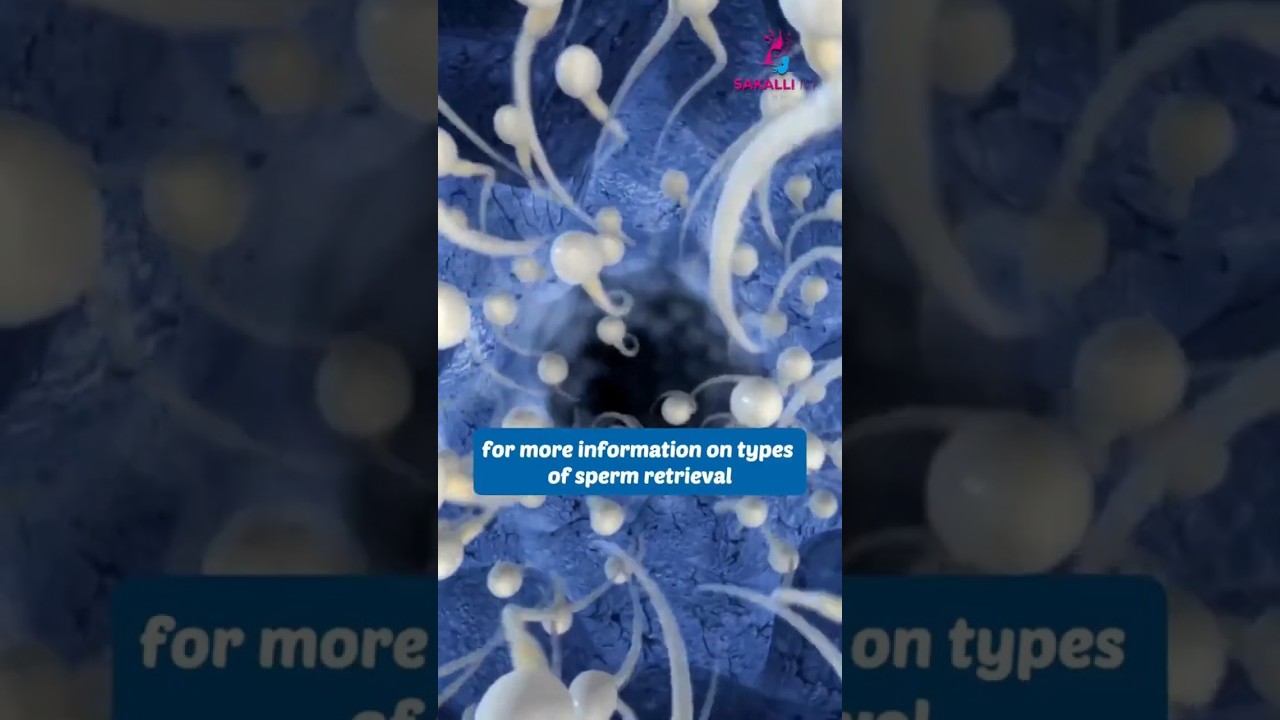 Why Cyprus IVF Fertility Center is My Top Choice for IVF Treatment