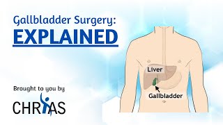 Gallbladder Surgery: Explained