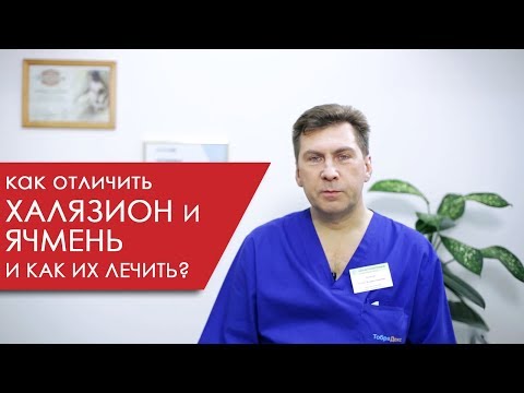 Видео: Chalazion на века - причини, лечение, народни средства