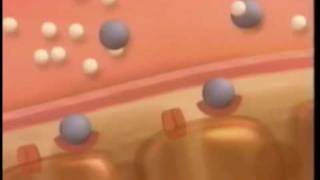 Obesity & Type 2 Diabetes