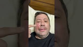 Staphylococcus Aureus Super Bacteria Causing Acute Facial Cellulitis