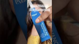 7 Days Testing Asaya Advanced Dark Spot Targeting gel To Fade Acne Marks #shorts