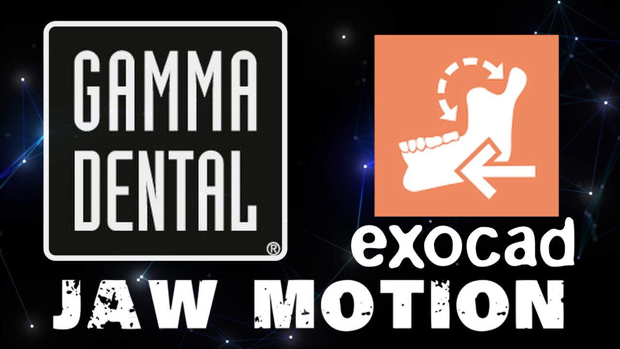 Связка exocad и Gamma Dental: моделирование в JAWMOTION