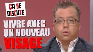 Accident domestique : comment a-t-il accepté son nouveau visage ? - Ça se discute