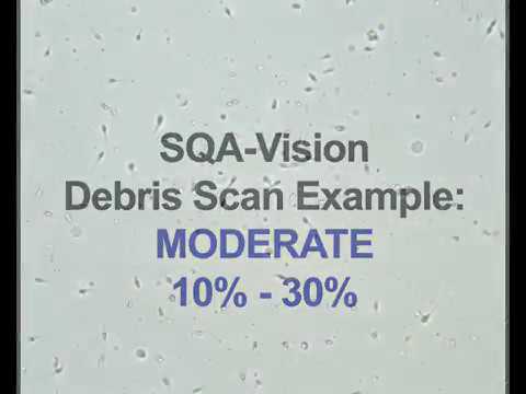 SQA-Vision Debris Scanner Reference Examples