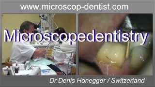 Microscope Dentistry training video(https://www.microscope-dentist.com Best practice training videos. Discover a new profession! The microscope is the ideal optical help, which allows evolving ..., 2014-11-16T22:07:25.000Z)