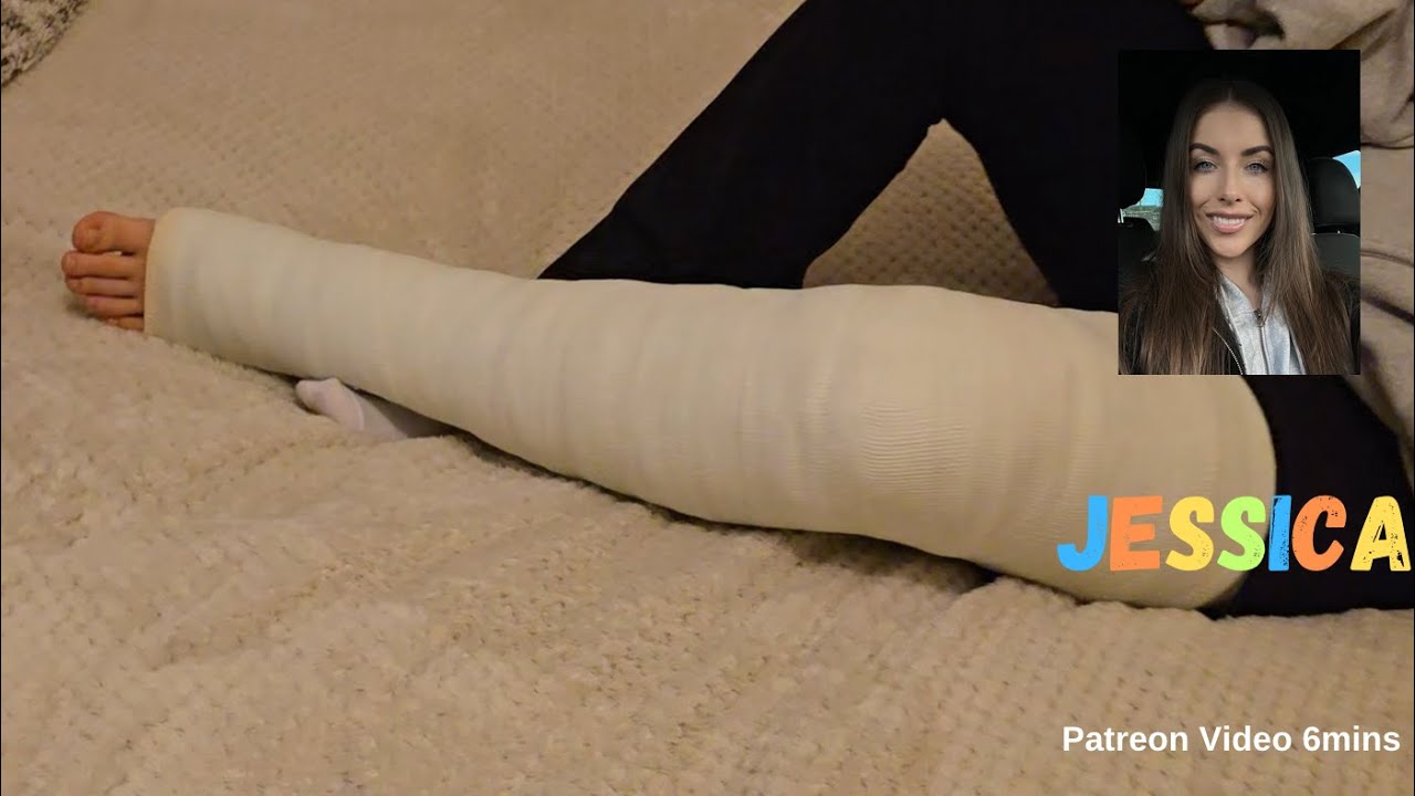 Long Leg Cast