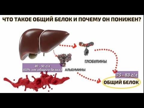 Wideo: Wzrost alfa globuliny?