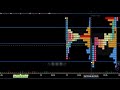 Trade Logic Daily 160226 | NIFTY BANKNIFTY | Market Profile | Volume Profile | Orderflow