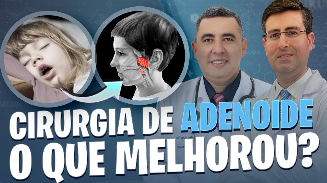CIRURGIA DE ADENOIDE - Criança com menos 2 anos pode fazer? Tem risco ...