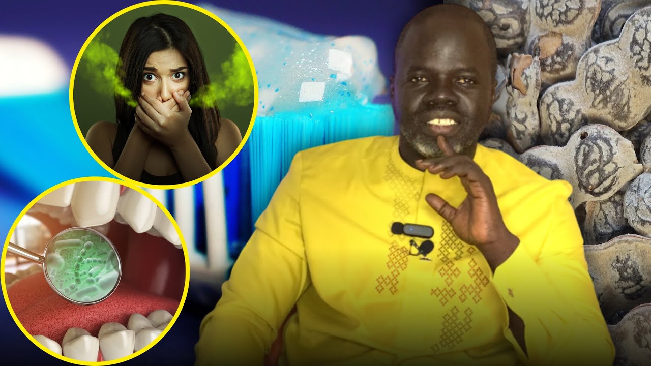 Mauvaise Haleine - ( Préventions et Solutions ) - Pr Ousmane Ndiaye - SAMA XALAAT T