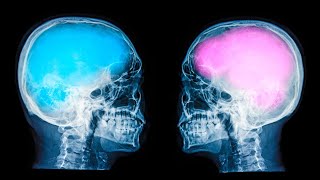 Where Is YOUR Mind? Call In w/KJ (1/16/26)