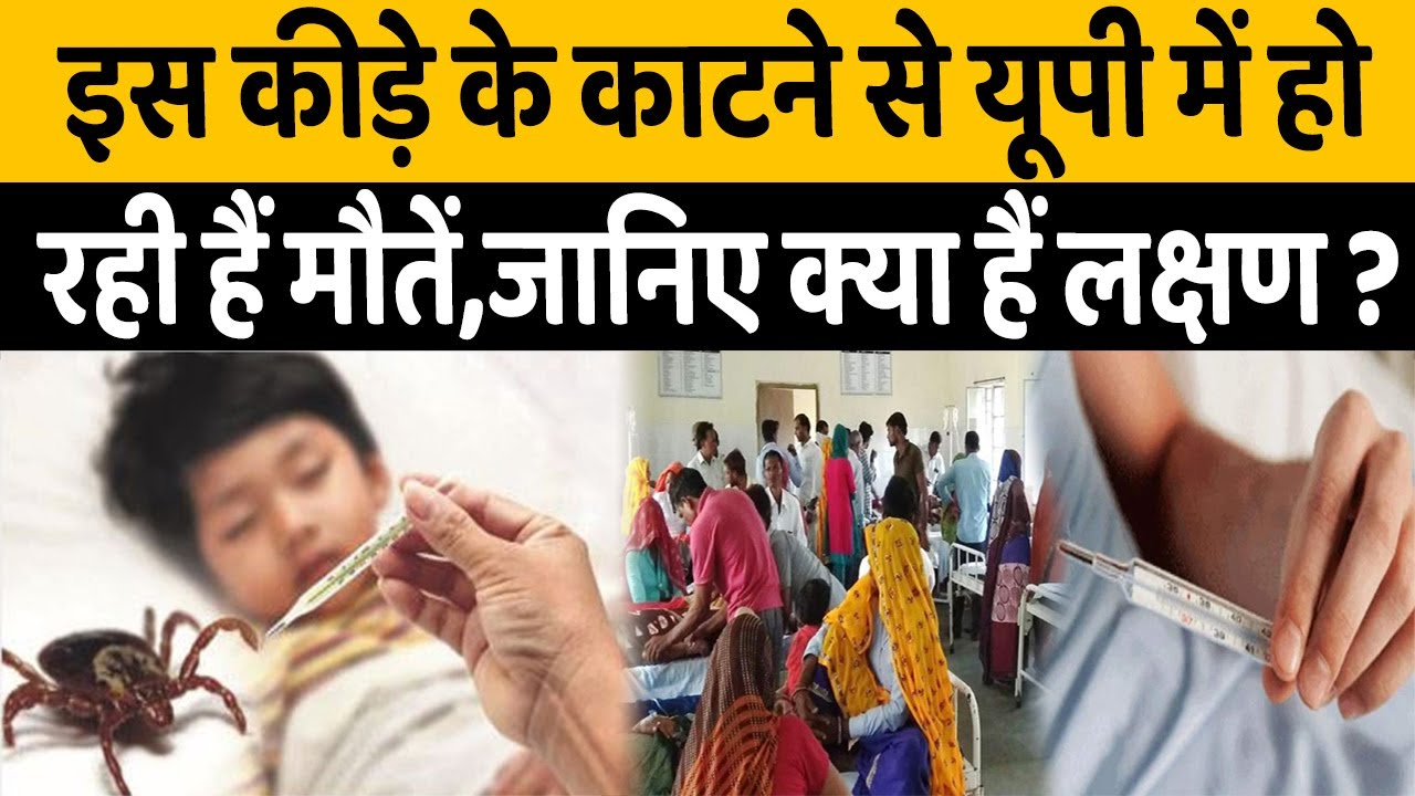 ⁣Scrub Typhus: Corona के बाद अब Scrub Typhus से मर रहे लोग| Firozabad|  #ViralFever