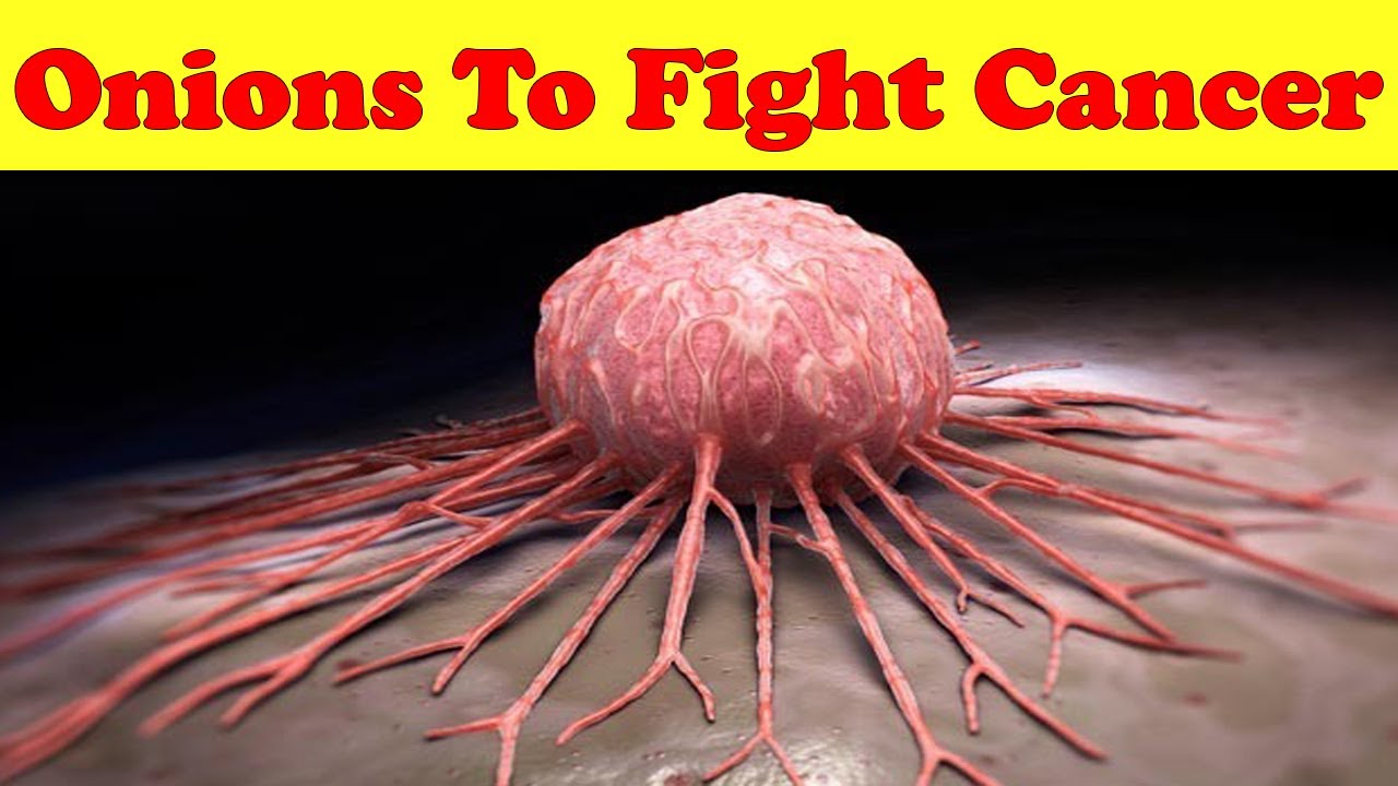 Onions That Kill Cancer Cells Benefits of Eating Raw Onions Everyday