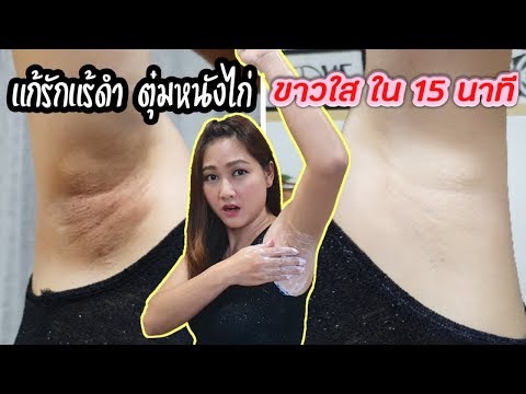 รักแร้ดำ ตุ่มหนังไก่ แก้ไม่ยาก ขาวใสขึ้นได้ ใน 15 นาที l สรรหามาทำ