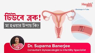ফযলপযন টউব বনধ থকল ম হওযর উপয ক How To Get Pregnant With Blocked Fallopian Tubes