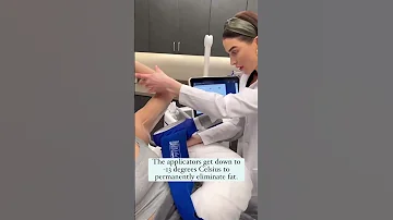 CoolSculpting Elite at The Skin Center