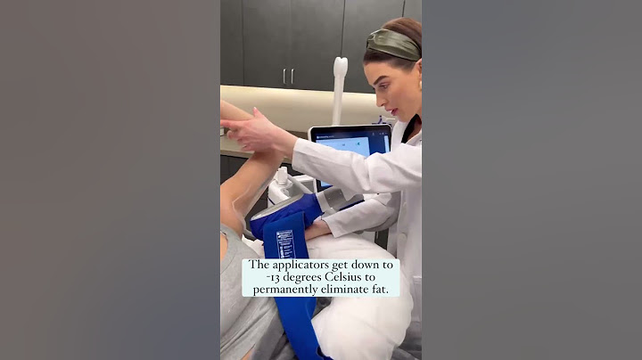 CoolSculpting Elite at The Skin Center