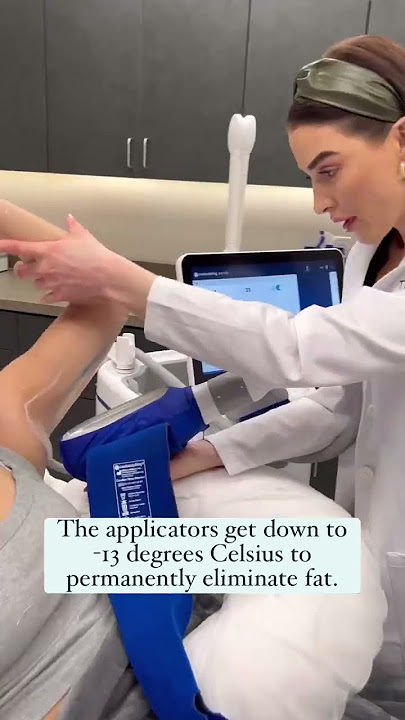 CoolSculpting Elite at The Skin Center
