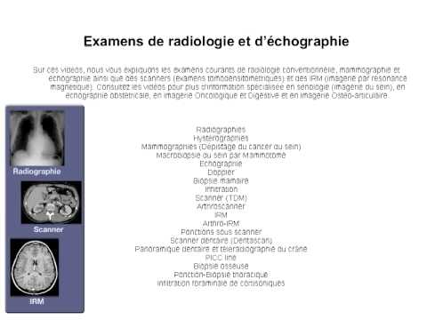 Radiologie à Montpellier, arthroScanner