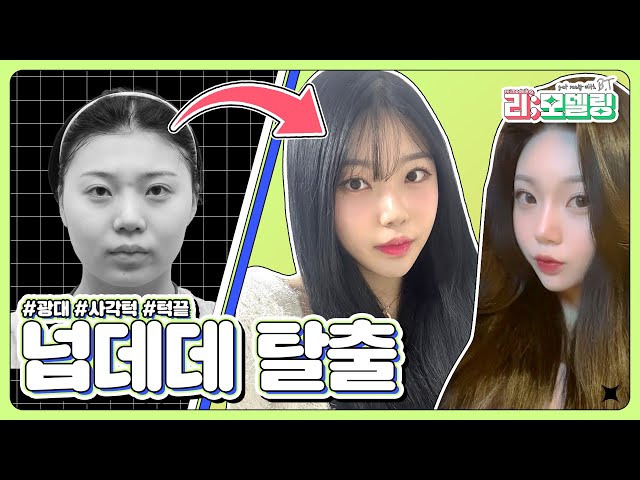 윤곽3종으로 넙데데 탈출 ㅣ비티성형외과