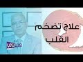 علاج تضخم القلب وطرق التشخيص