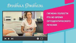 Гигиена полости рта во время ортодонтического лечения. Советы врача Дентал Фэнтези.(Стоматология для детей и взрослых на http://www.dentalfantasy.ru/ Гигиена полости рта. Использование ортодонтических..., 2015-09-28T17:13:29.000Z)