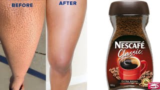 Comment se débarrasser des jambes de fraise avec du café en 1 jour Naturellement à la maison à 100% screenshot 4