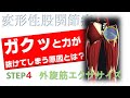 vol.39 股関節がガクッとなり痛みが出る方に対する安定性向上エクササイズ‼