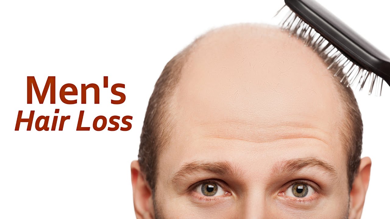 Men S Hair Loss 84