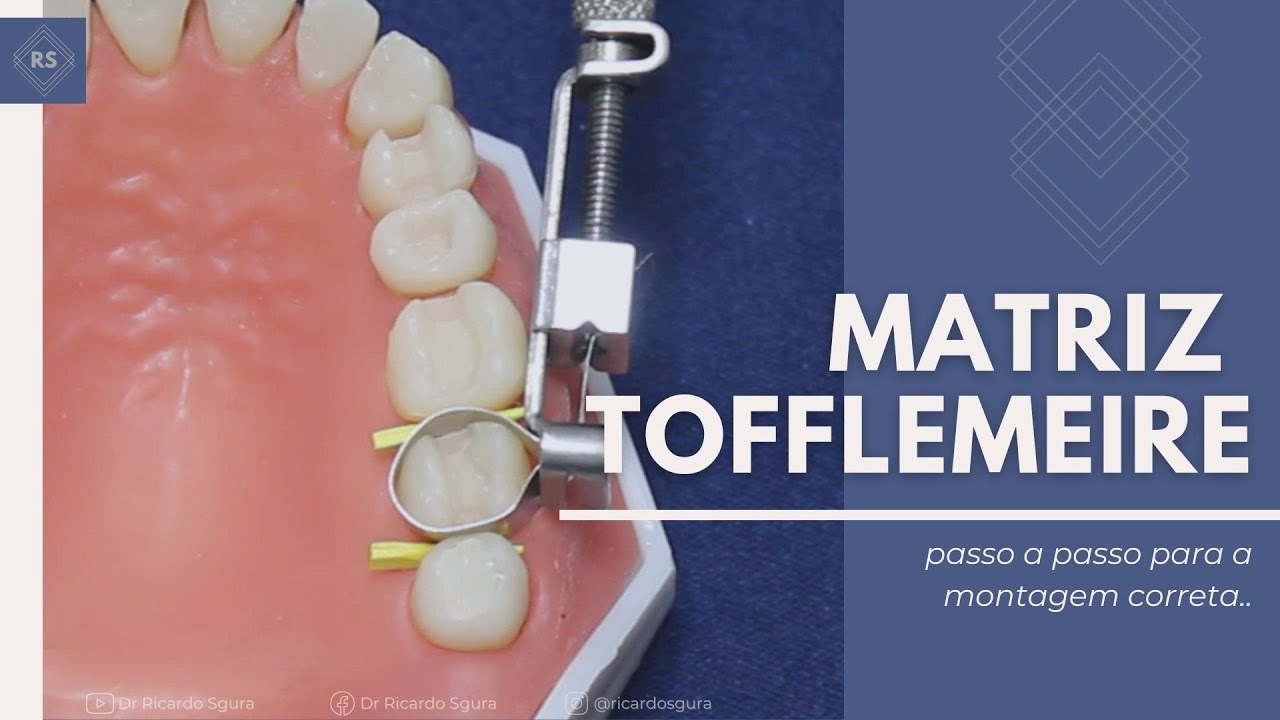 Porta-matriz Tofflemire