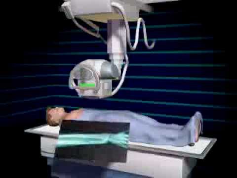 how x ray Works
