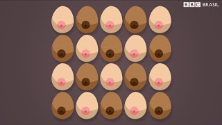 Os Sintomas Menos Conhecidos Do Câncer De Mama - Além Dos Caroços No Seio