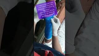 Fracture Lower End Radius Closed Reduction Fiberglass Plastering Adamya Hospital Videos