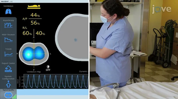 Monitoring Lung Function with TIMPEL EIT the ICU.