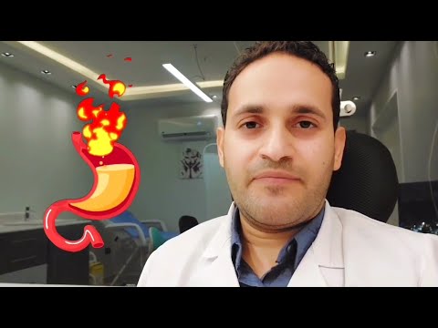 فيديو: ما هو حرقان المعدة؟
