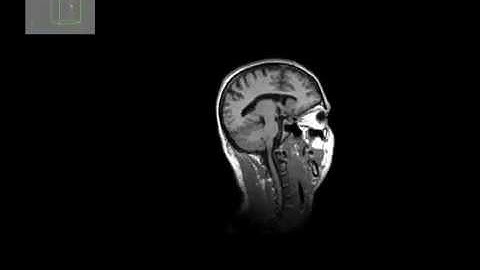 SupplementaryVideo 09